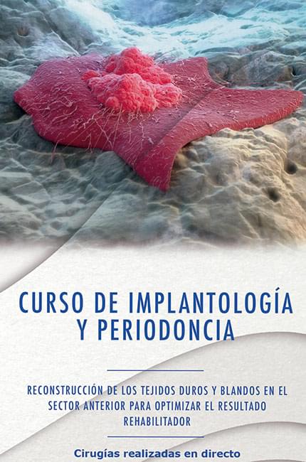 Los próximos días 28, 29 y 30 de abril se celebrará un Curso de Implantología y Periodoncia en las instalaciones de la Fundación Clínica Pardiñas.  