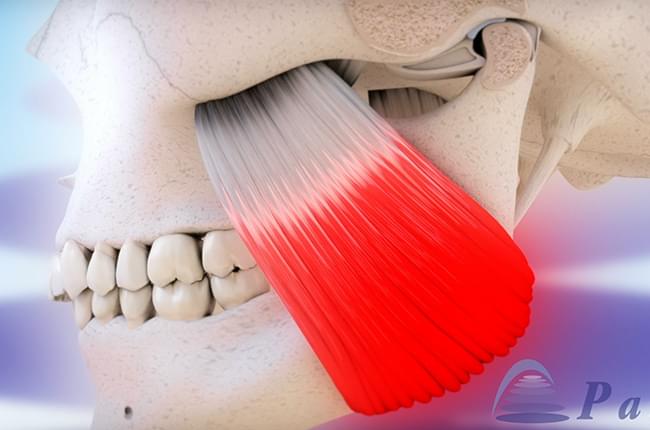 Vídeo 3D sobre a  disfunción temporomandibular, un problema na articulación que une a mandíbula co cranio e que pode ser unha consecuencia directa do bruxismo.
