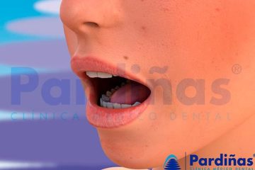 boca seca causas