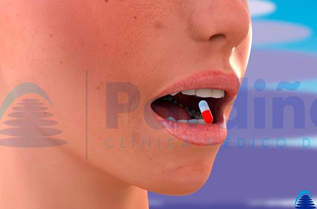 boca seca tratamiento
